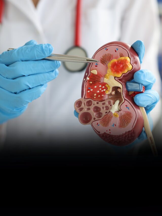 Your Kidneys Could Be in Danger: Signs to Watch For